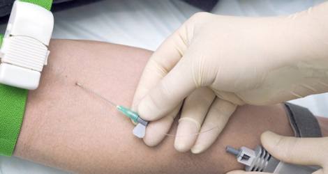  ПРЕИМУЩЕСТВА ВЛОК: