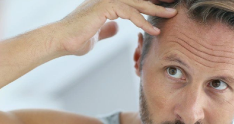  СИМПТОМЫ ПРИ АЛОПЕЦИИ