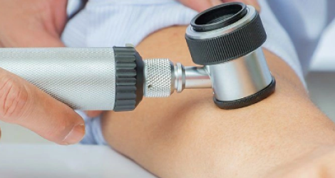  СИМПТОМЫ ПРИ ЛИШАЕ: