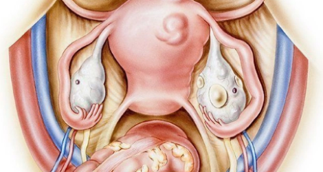  СИМПТОМЫ ПРИ ПОЛИКИСТОЗЕ ЯИЧНИКОВ: