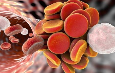 СИМПТОМЫ ПРИ ТРОМБОЗЕ ГЕМОРРОИДАЛЬНЫХ УЗЛОВ